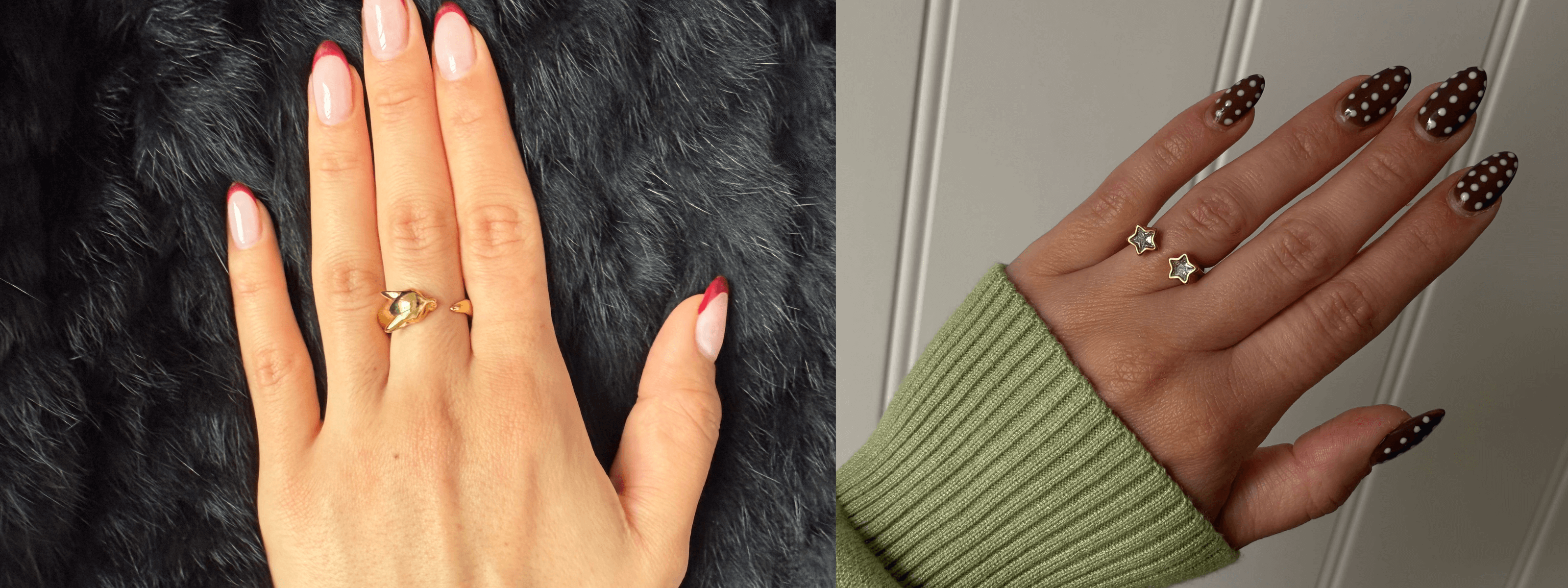 Comparing Hypoallergenic Metals: Titanium, Niobium, and Steel